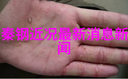 网红雪梨面临新挑战脸部表情失去魅力